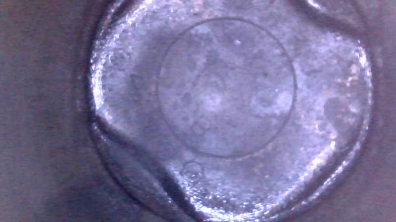 Part 10 - Additional view