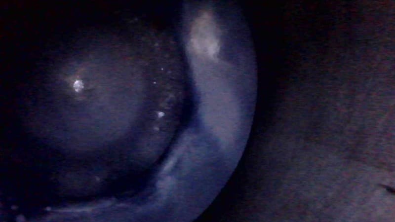 Part 17 - Additional view