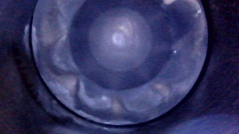 Part 24 - Additional view