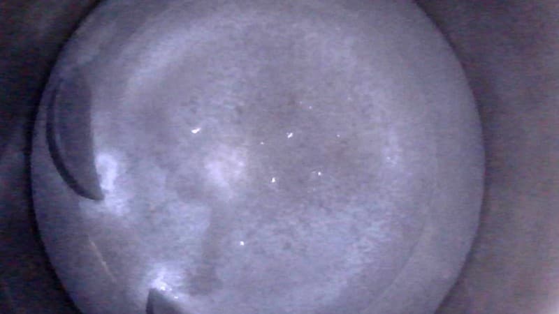 Part 15 - Additional view