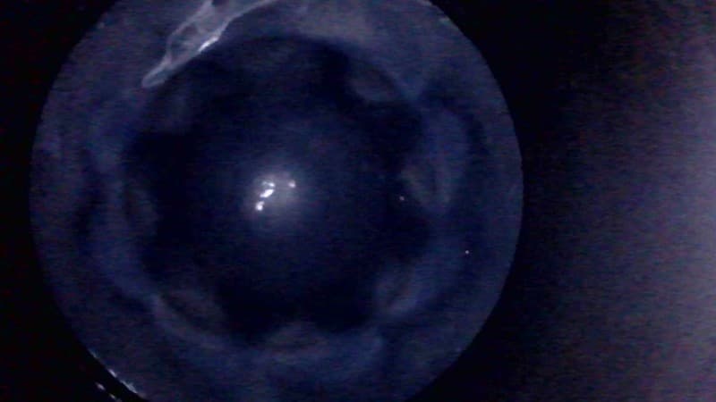 Part 15 - Additional view