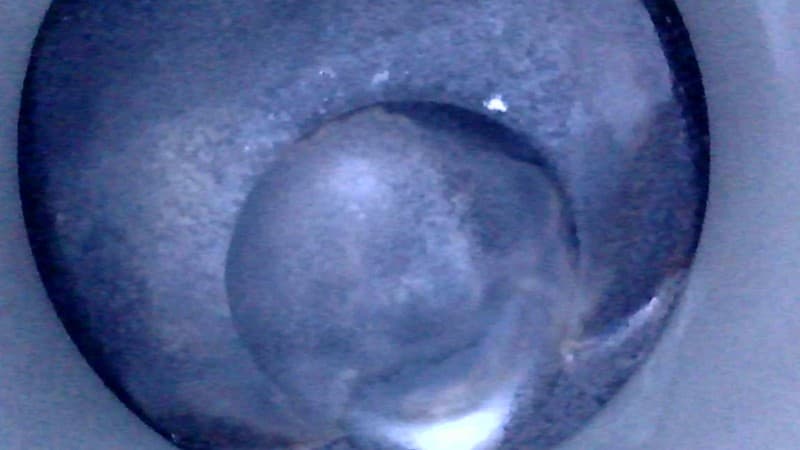 Part 28 - Additional view