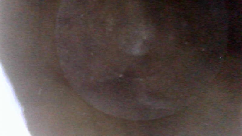 Part 14 - Additional view