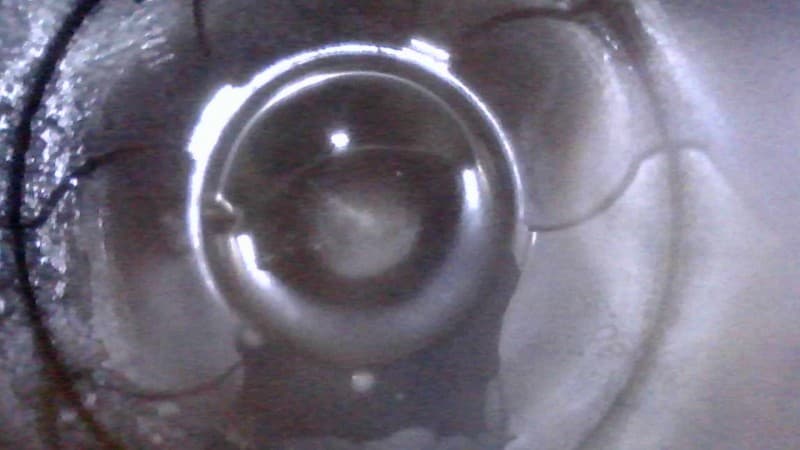 Part 19 - Additional view
