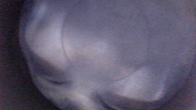 Part 21 - Additional view